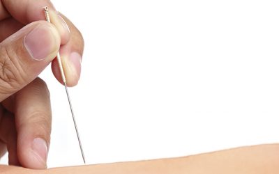 Punción seca en fisioterapia, definición y ventajas de su uso